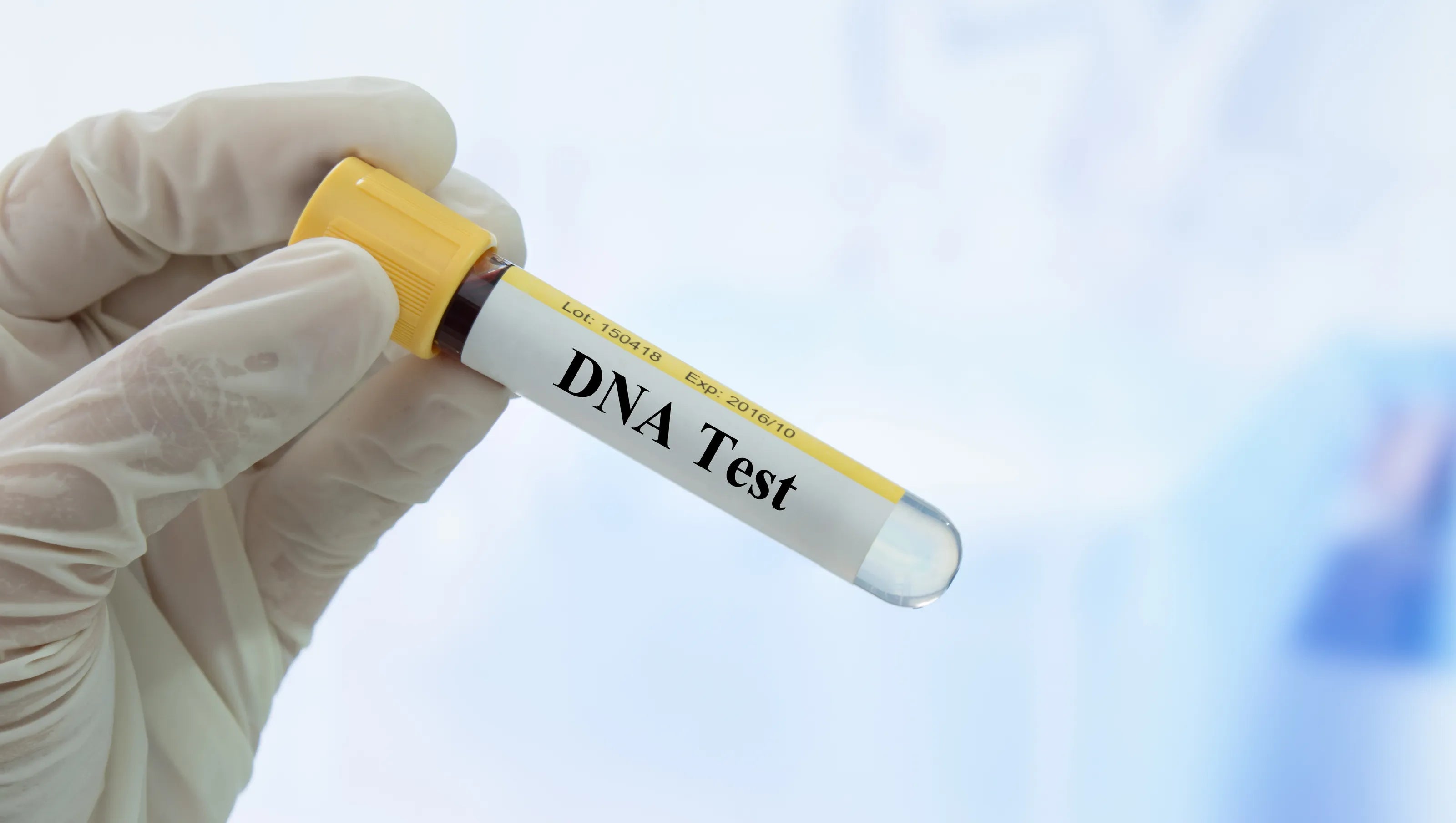 DNA Testing